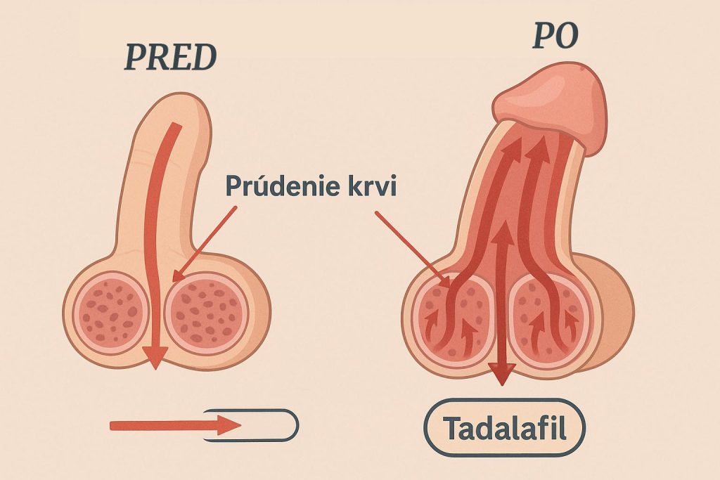 Tadalafil bez predpisu